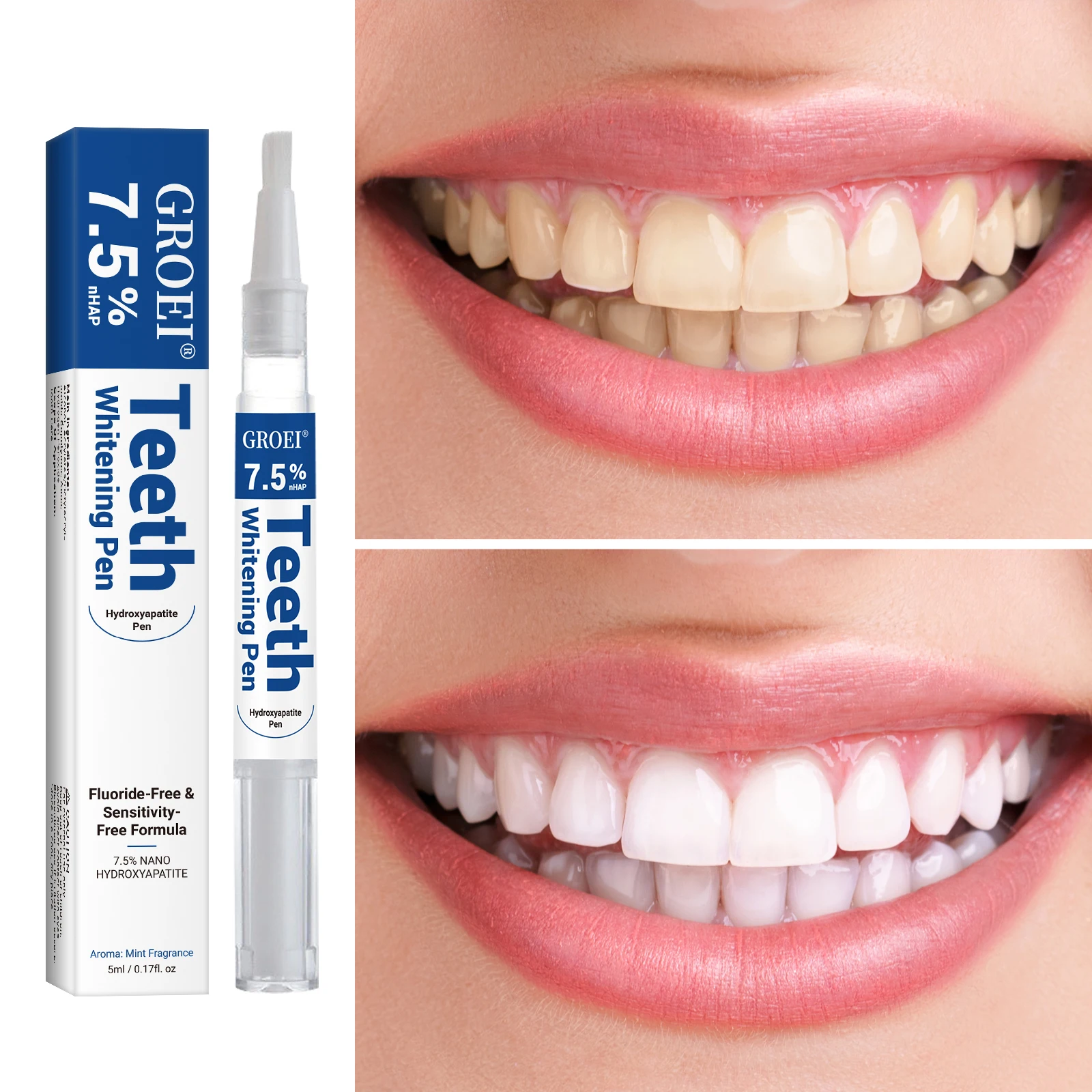 Caneta branqueadora de dente h - Teeth Whitening Before And After avaliação e preço