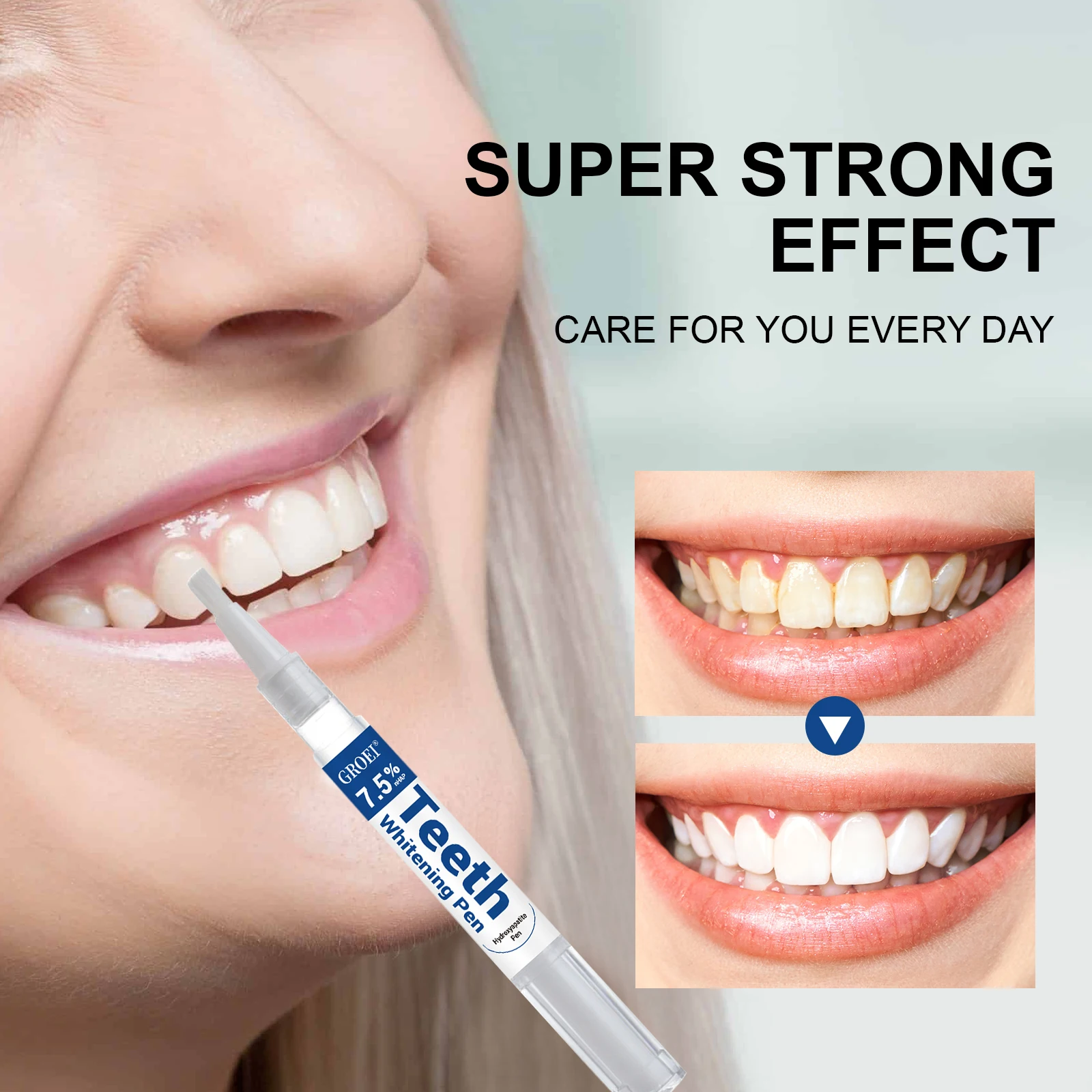 Caneta branqueadora de dente h - Teeth Whitening Before And After avaliação e preço