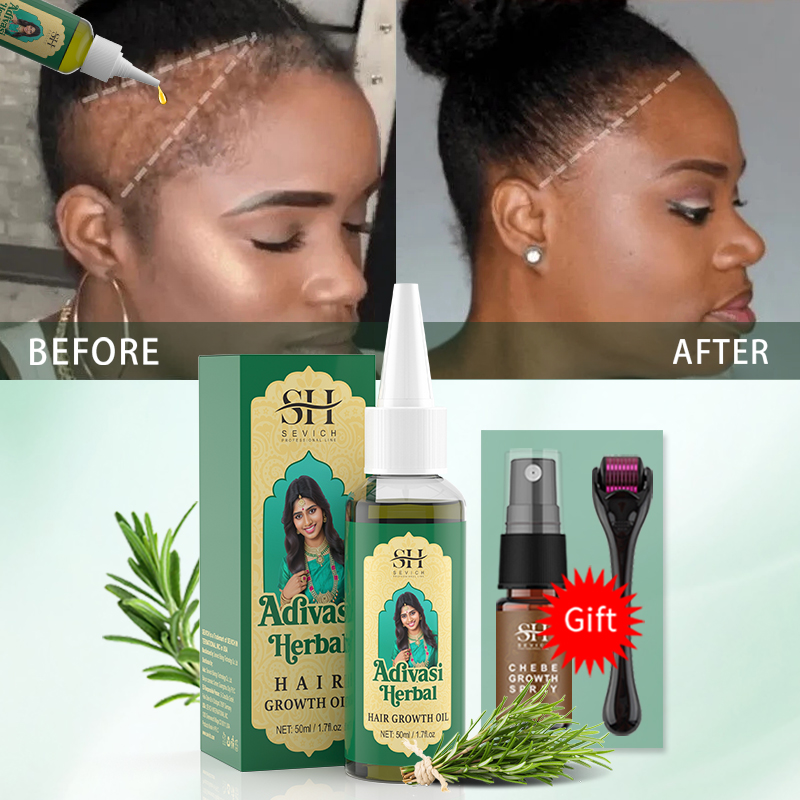 Óleo Ayurvédico para Crescimen - Coconut Oil Pull avaliação e preço