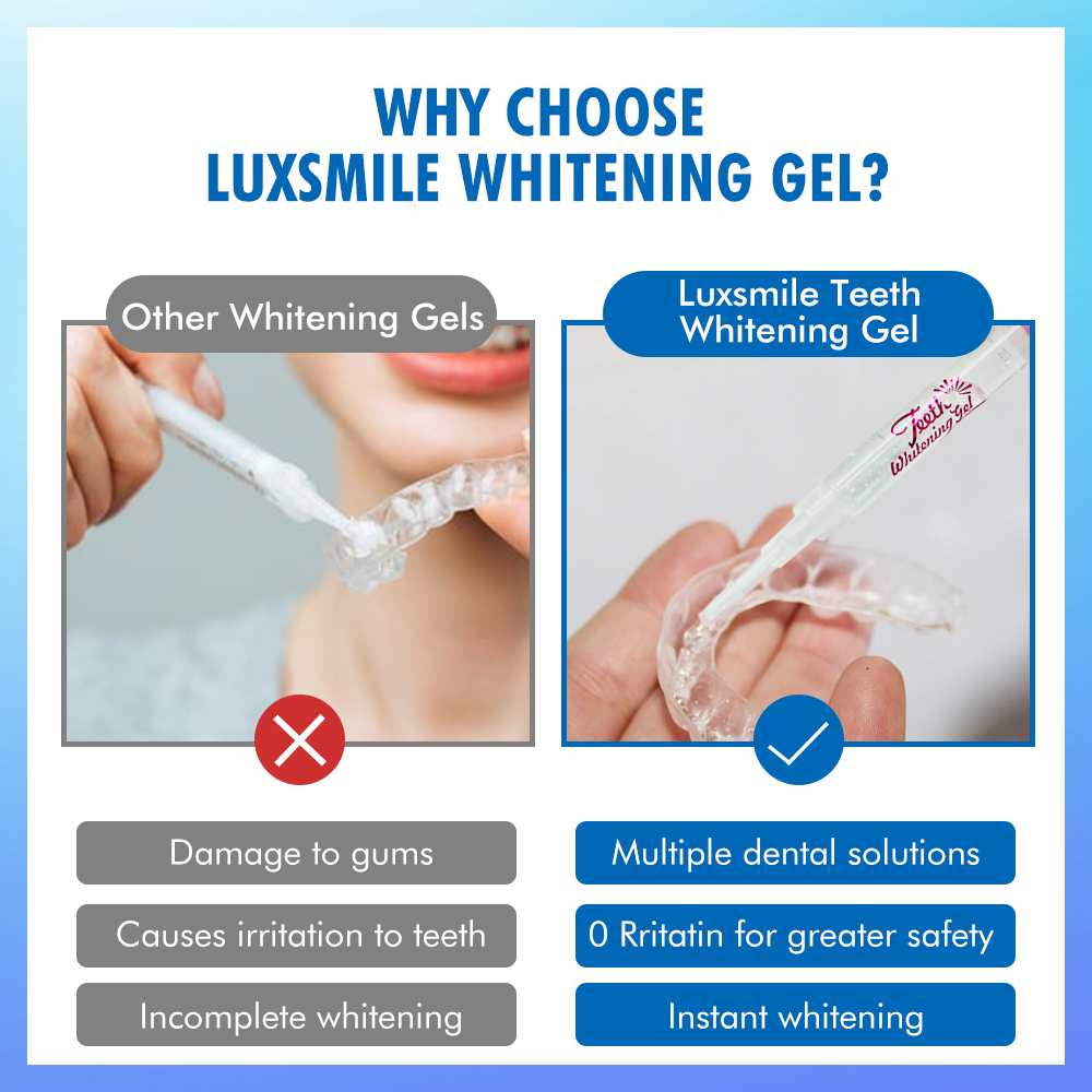 Gel Clareador Dental PAP ou 35 - Teeth Whitening Before And After avaliação e preço
