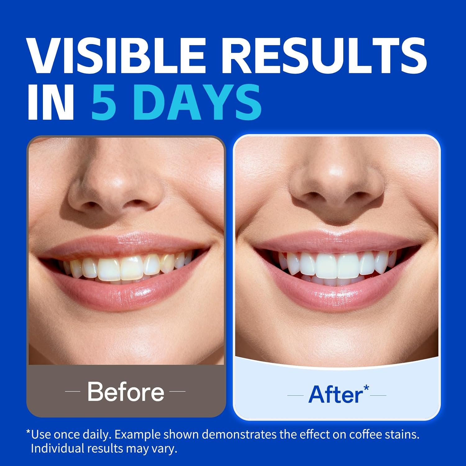 7 pares de tiras clareadoras d - Teeth Whitening Strips Crest avaliação e preço