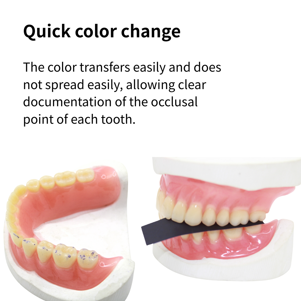 Papel de Articulação Odontológ - Teeth Whitening Street avaliação e preço