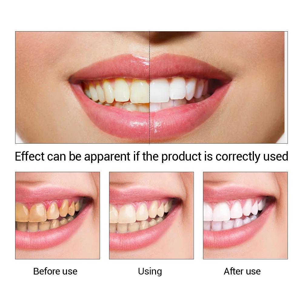 FTEENPLY Essência para claream - Teeth Whitening From Home avaliação e preço